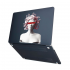 Чехол-накладка Hustle Case Gorgona Black для MacBook Air 13" (M1 | 2020 | 2019 | 2018)